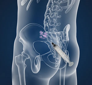 b12 injection singapore B12 Vitamin Shot with 10000 MCG Highest Potency - Sugar-Free, Caffeine-Free